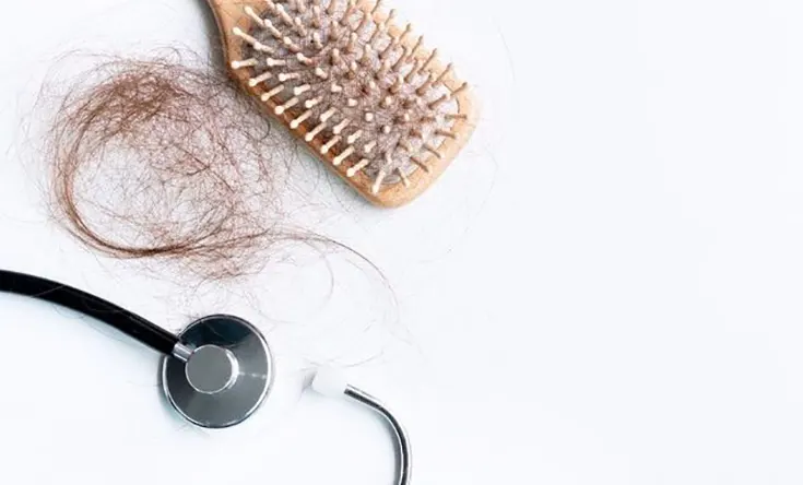 درمان ریزش موی هورمونی در زنان